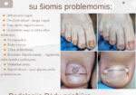 Podologija – Pėdų priežiūra Gargždai