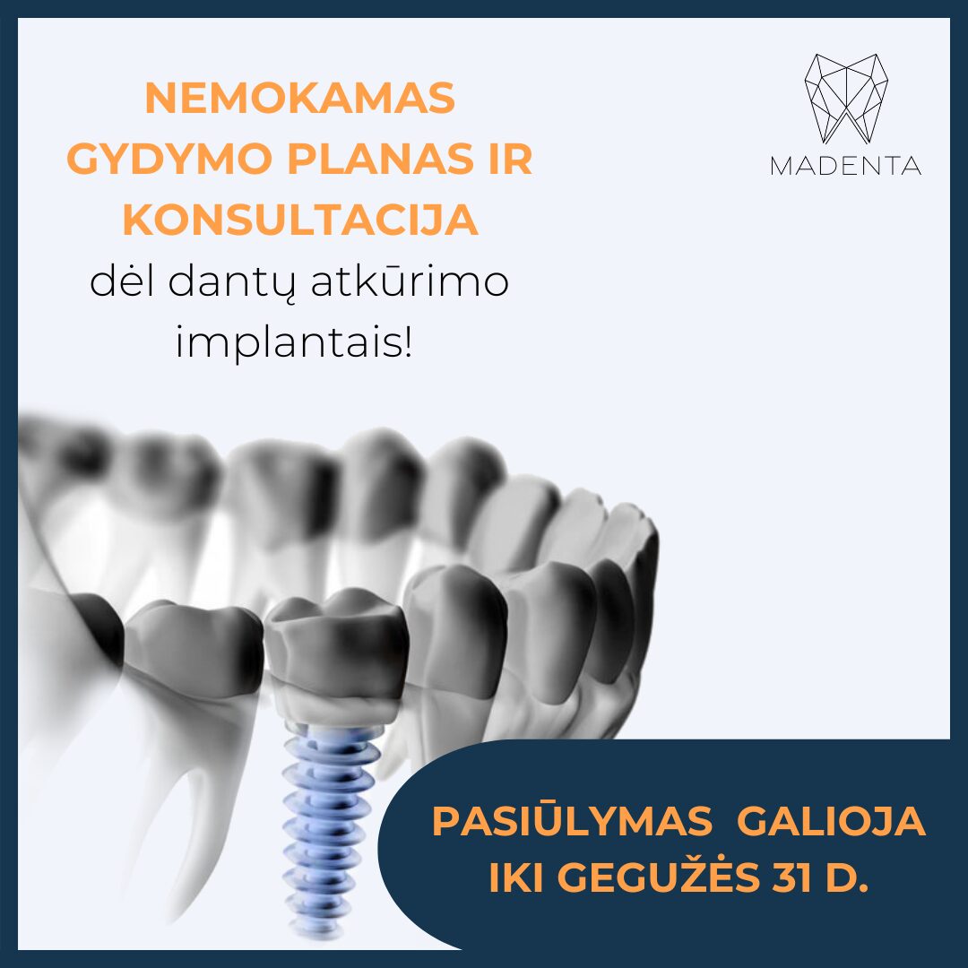 Nemokama konsultacija dėl implantacijos