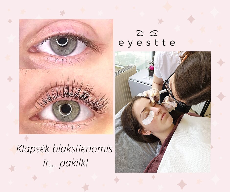 Blakstienų laminavimo procedūra