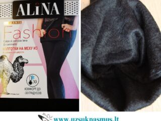 pedkelnes_kupranugario_vilna_alina